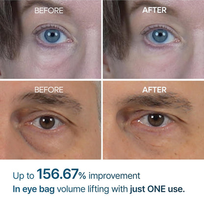 Dr.Melaxil™ Eyephalt Eyebag Cream